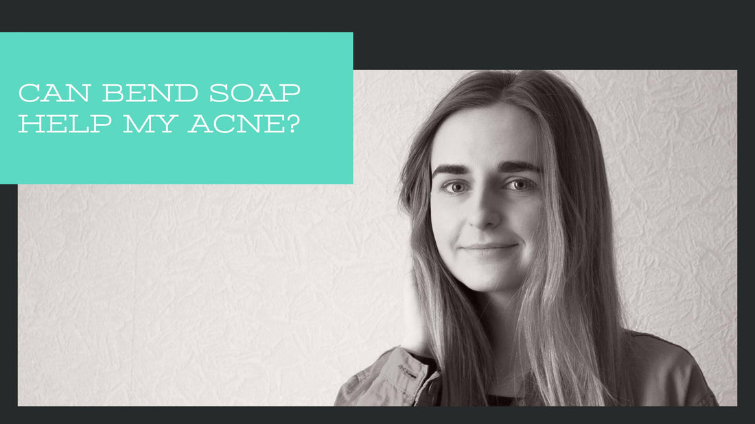 Can Bend Soap Help My Acne?