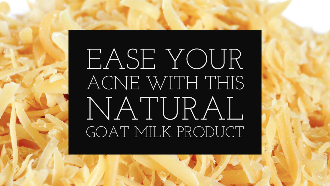 Ease Your Acne With This Natural Goat Milk Product